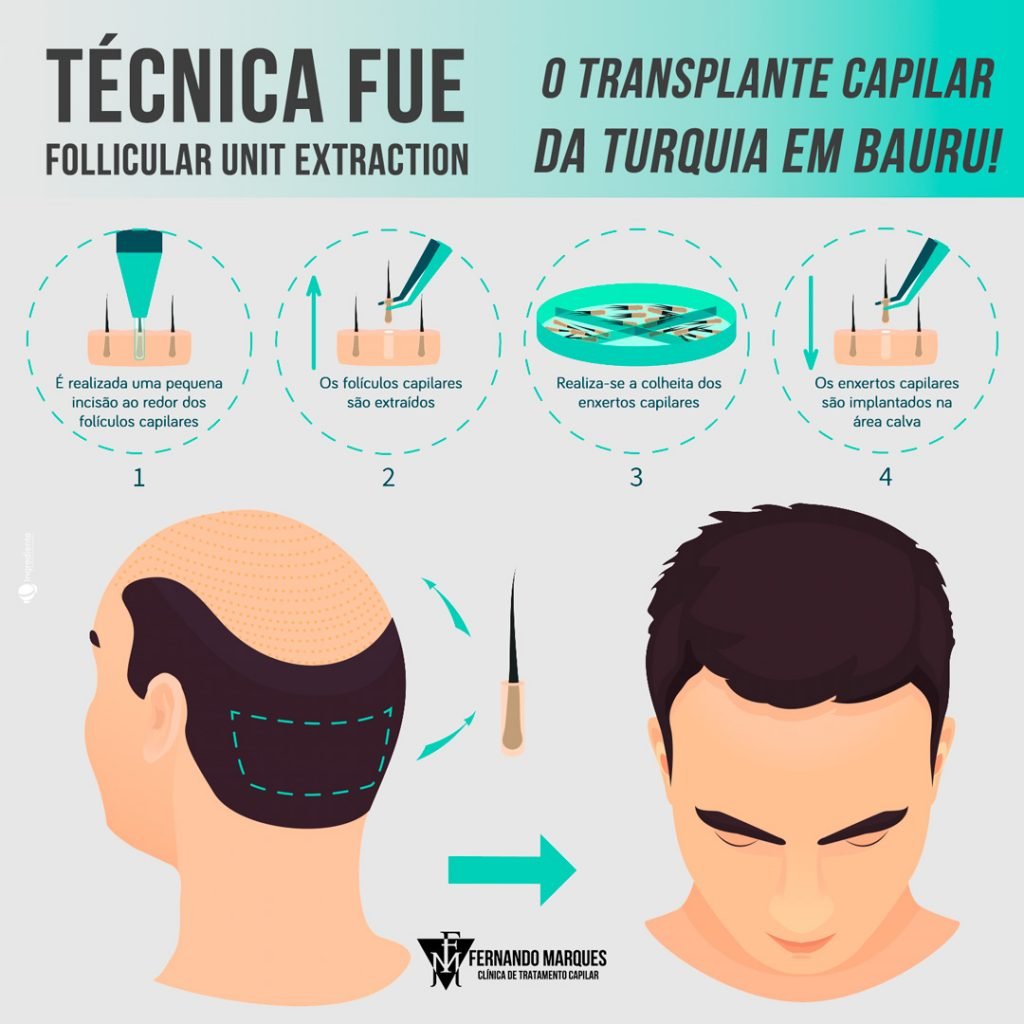 seo-tecnica-fue-fernando-marques-1